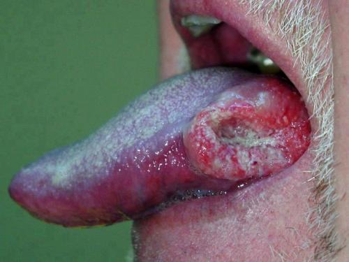 Dangers Of Oral Sex 59