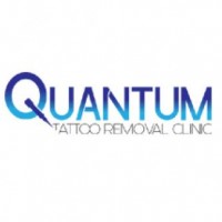 Quantum Tattoo Removal Clinic