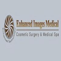 Enhanced Images Medical