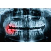 Rockwell Oral and Facial Surgery